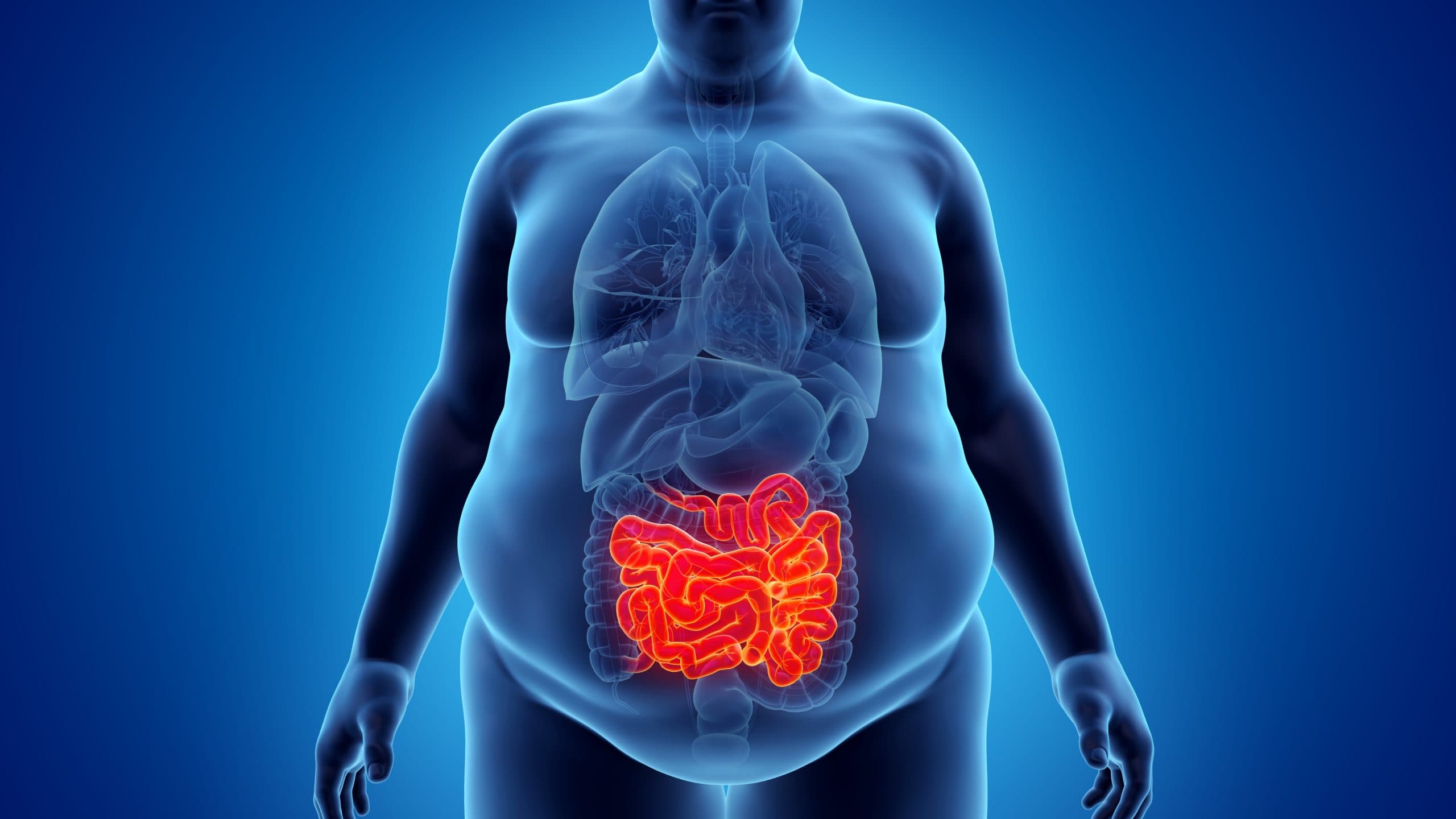3d,rendered,illustration,of,an,obese,mans,small,intestine